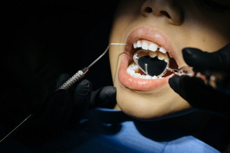 pediatric dental fillings