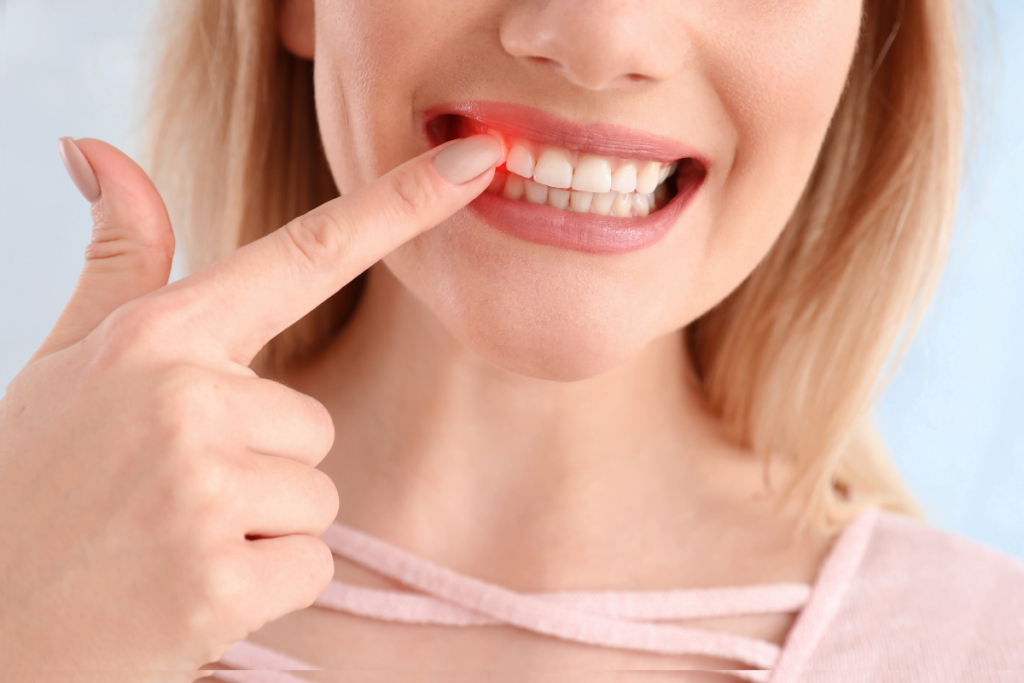 Can Periodontal Disease Be Completely Cured?